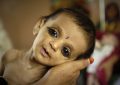 حدود ۲ و نیم میلیون کودک در کشور از سوء تغذیه رنج می‎برند