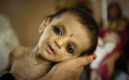 حدود ۲ و نیم میلیون کودک در کشور از سوء تغذیه رنج می‎برند
