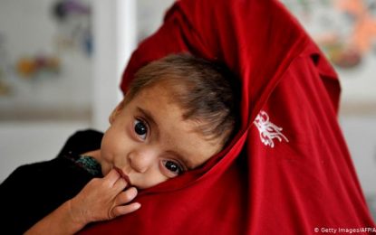 یونیسف: دو میلیون کودک در افغانستان دچار سوء تغذیه می‎باشند
