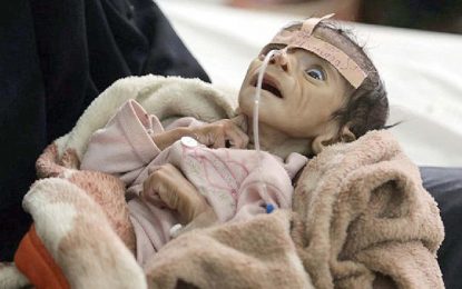 پیامد‌های جنگ در یمن: هر ۱۱ دقیقه یک کودک جان می‌دهد