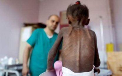 ۸۵ هزار کودک یمنی در اثر جنگ‌ها در این کشور جان باخته‌اند