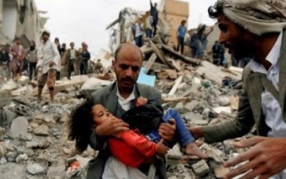 یونیسف: بیش از ۶۷۰۰ کودک یمنی از آغاز جنگ داخلی تا کنون در یمن کشته شده است