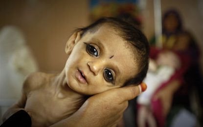 دو میلیون کودک در کشور به دلیل سوء تغذیه به رشد کامل نمی‌رسند